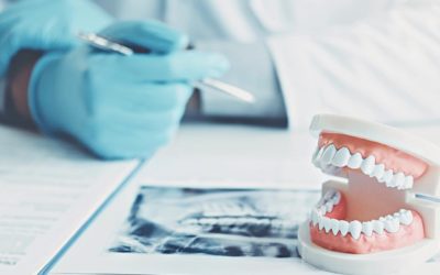 ¿Cuáles son las características de las prótesis dentales?