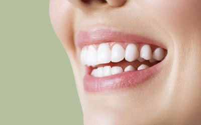 Todo lo que necesitas saber antes de hacerte un blanqueamiento dental