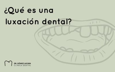 ¿Qué es una luxación dental?