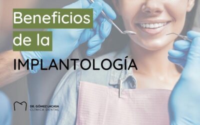 Beneficios de la implantología
