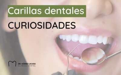 Curiosidades de las carillas dentales