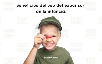 ¿Qué es un expansor del paladar?