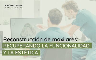 Reconstrucción de maxilares para recuperar la funcionalidad y la estética