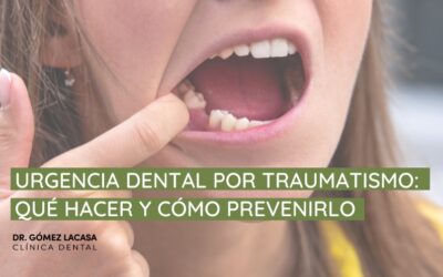 Urgencia dental por traumatismo: qué hacer y cómo prevenirlo