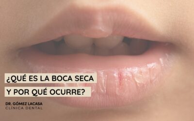 Xerostomía, ¿por qué tengo la boca seca?
