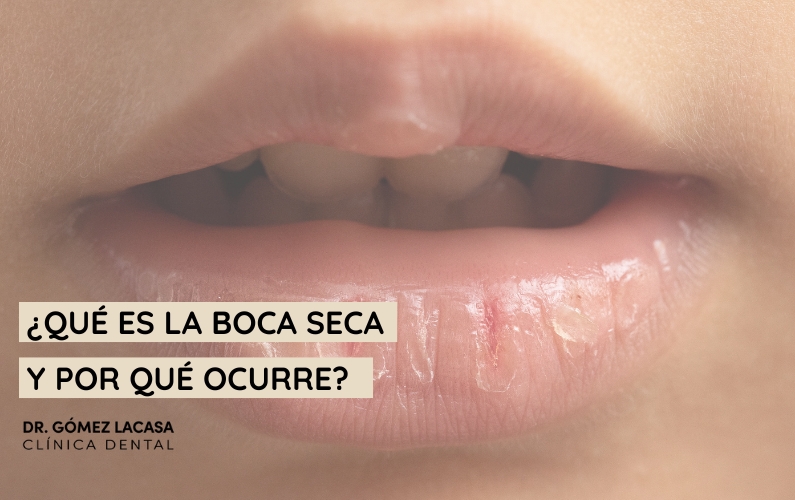 Xerostomía, ¿por qué tengo la boca seca?