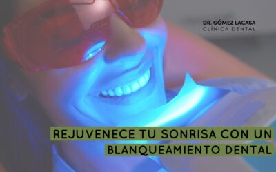 Rejuvenece tu sonrisa con un blanqueamiento dental