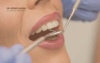 Estética dental: Cómo mejorar tu confianza al sonreír